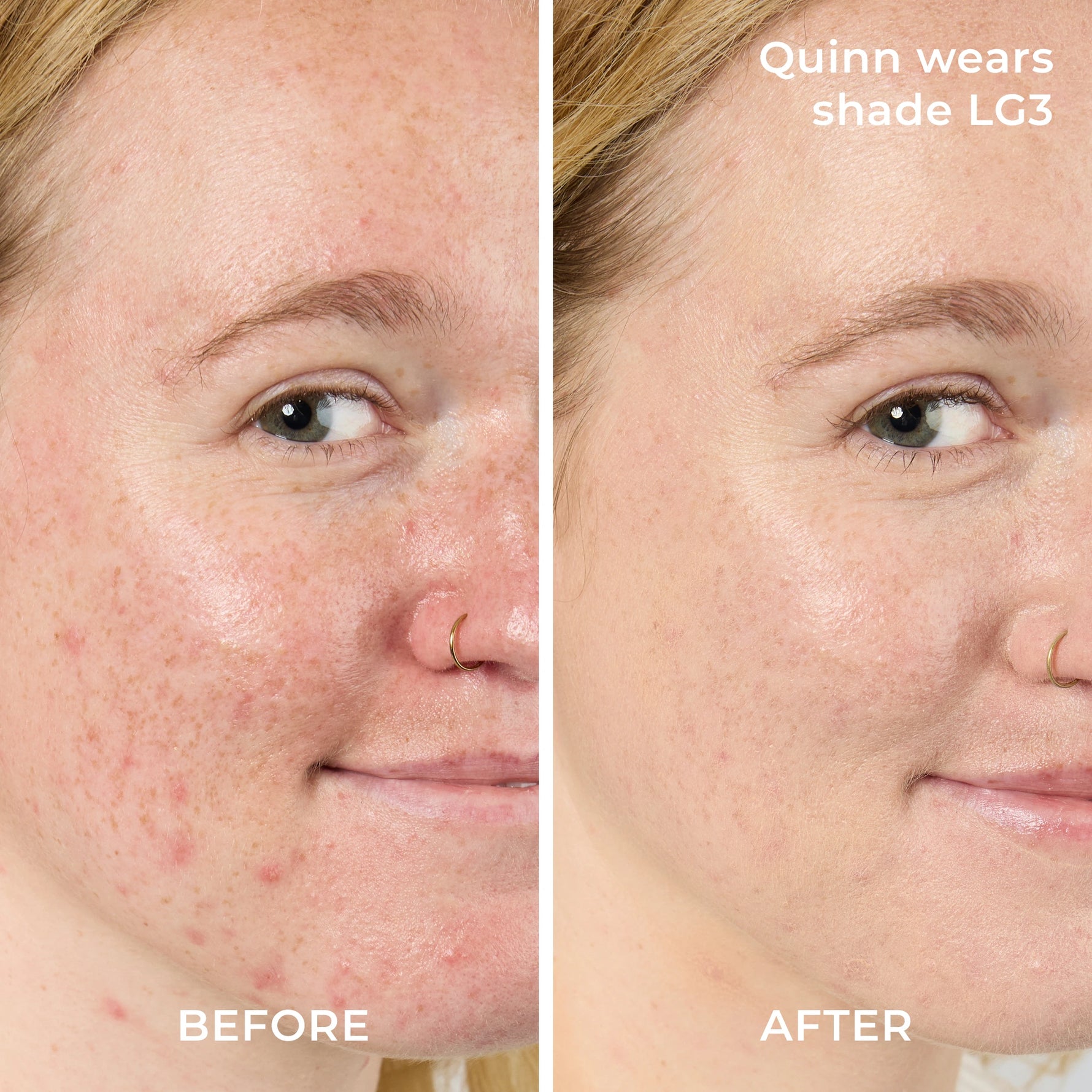 Model Quinn Before and After Shade LG3 