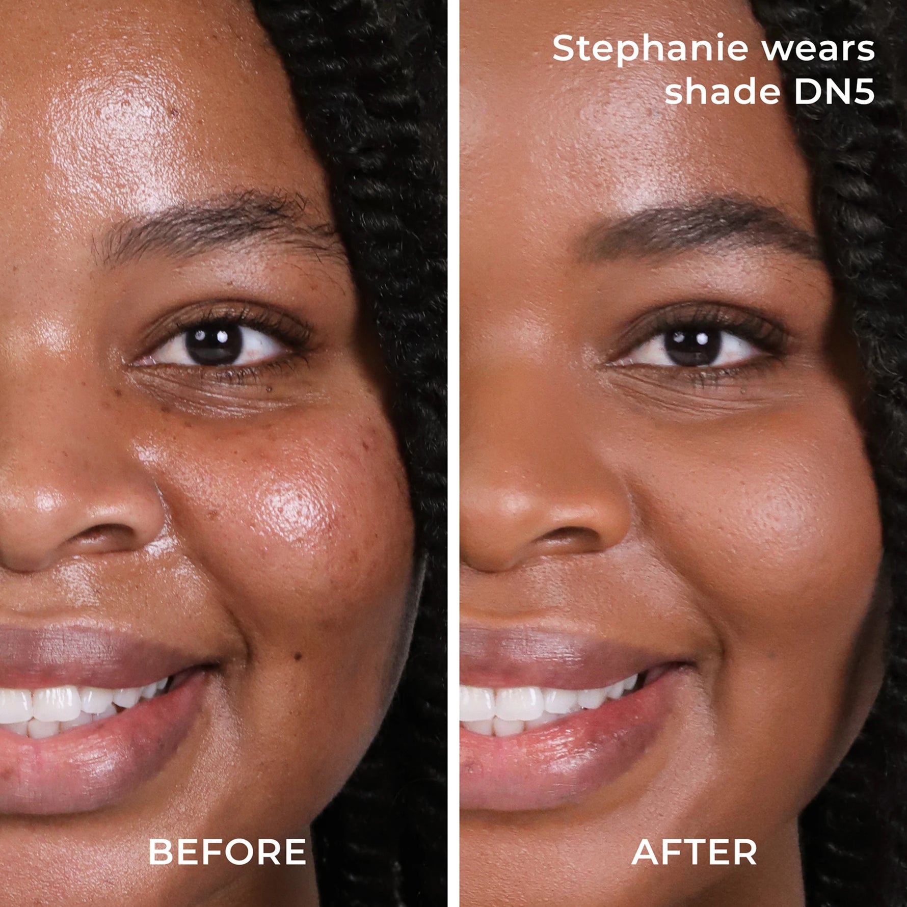 Before and after results DN5 