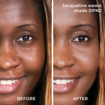 Before and after results DPN2 