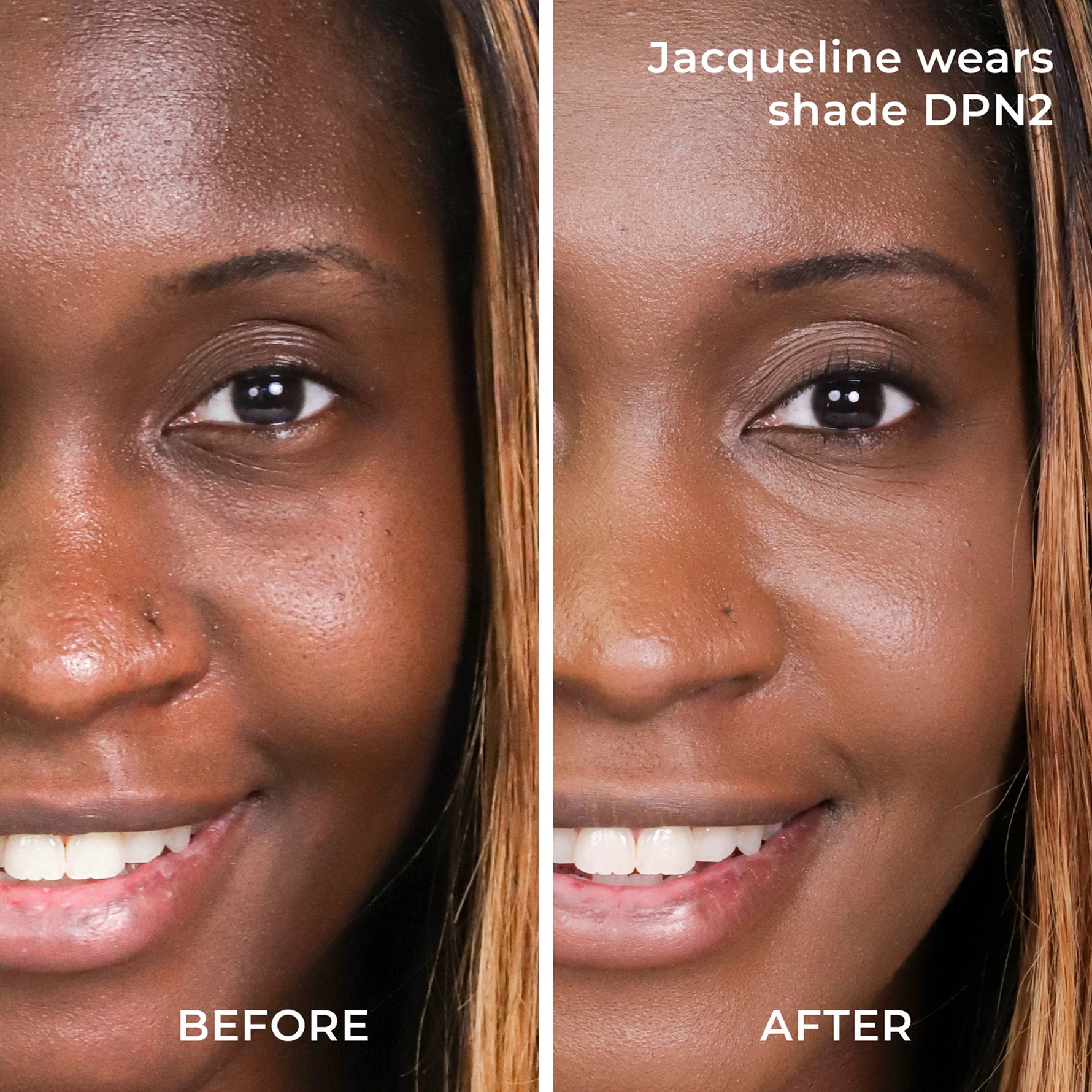 Before and after results DPN2 