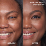 Before and after results DPP1 