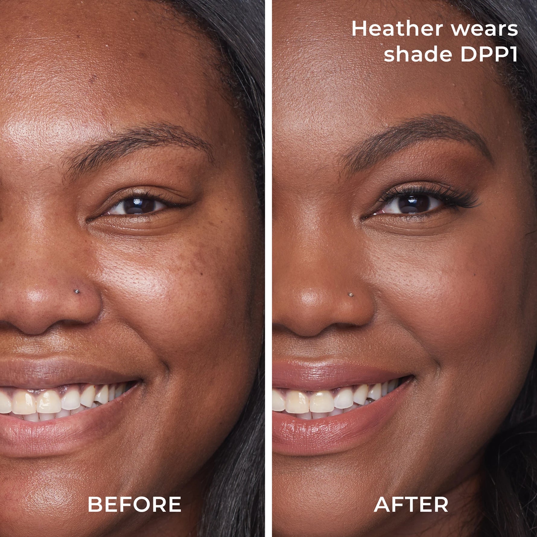 Before and after results DPP1 