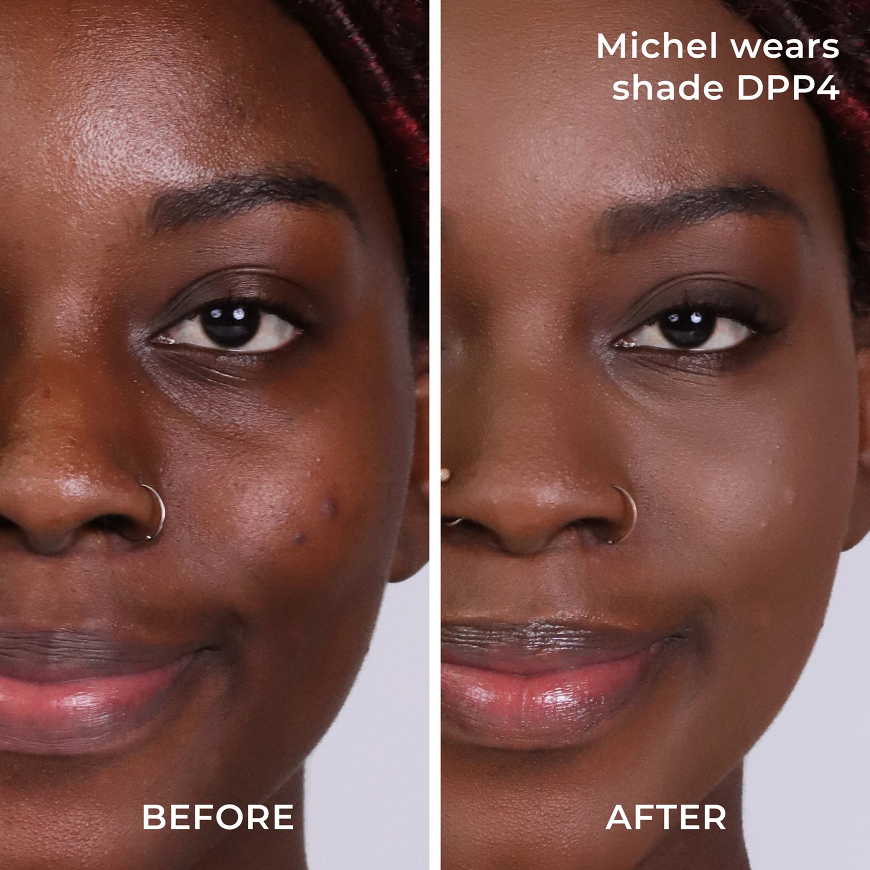 Before and after results DPP4 