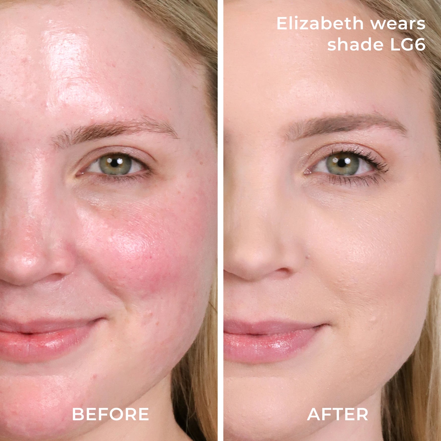 Before and after results LG6 