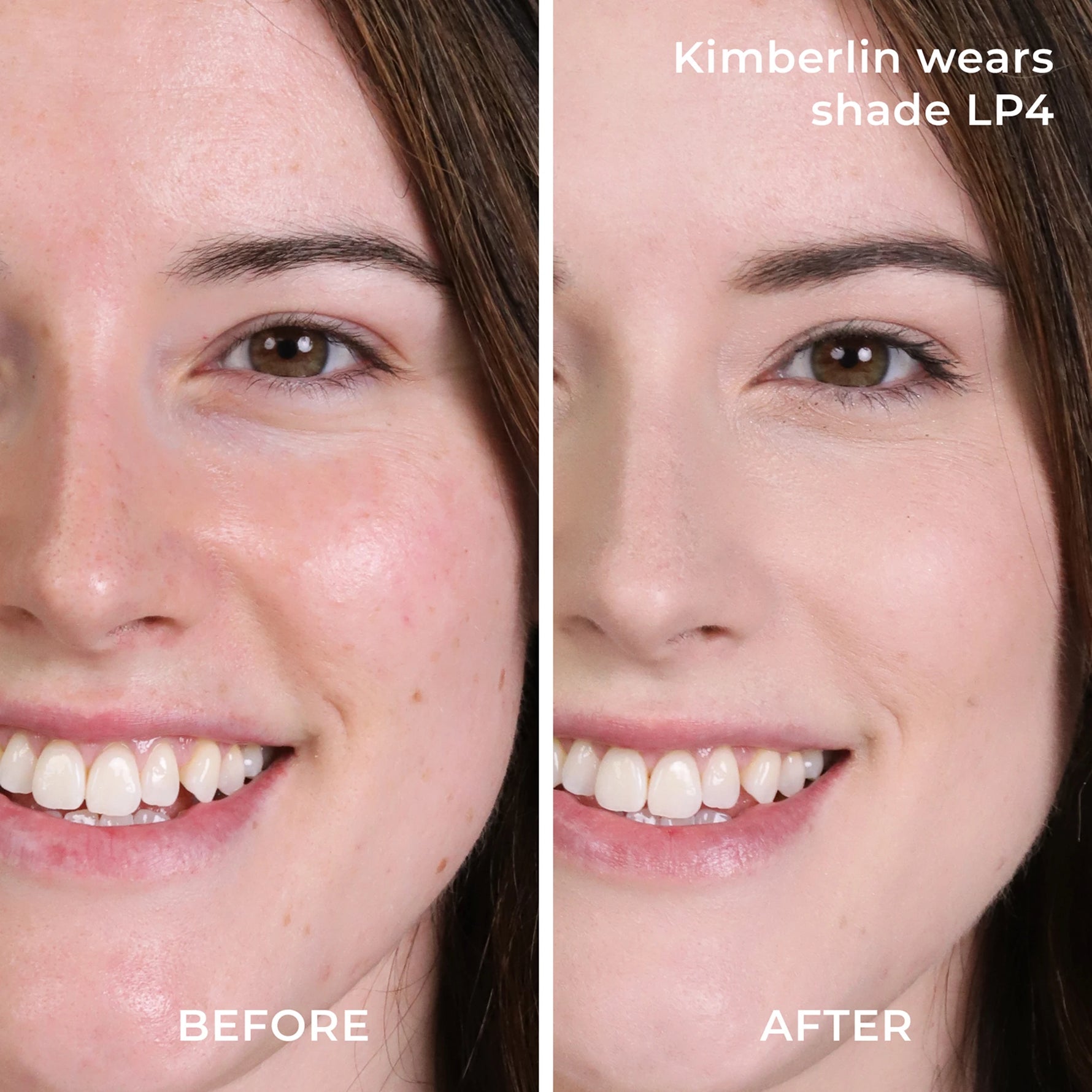 Before and after results with LP4 powder foundation 