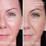 Before and after results LP5 