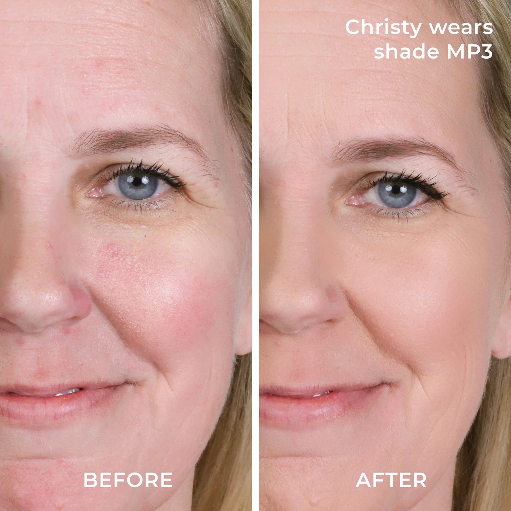 Before and after results MP3 