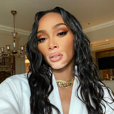Winnie Harlow with dark long and curly hair Selfie 