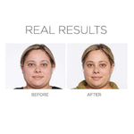 4 - in - 1 Correcting Primer Anti - Blemish & Mattifying Primer - PÜR Beauty