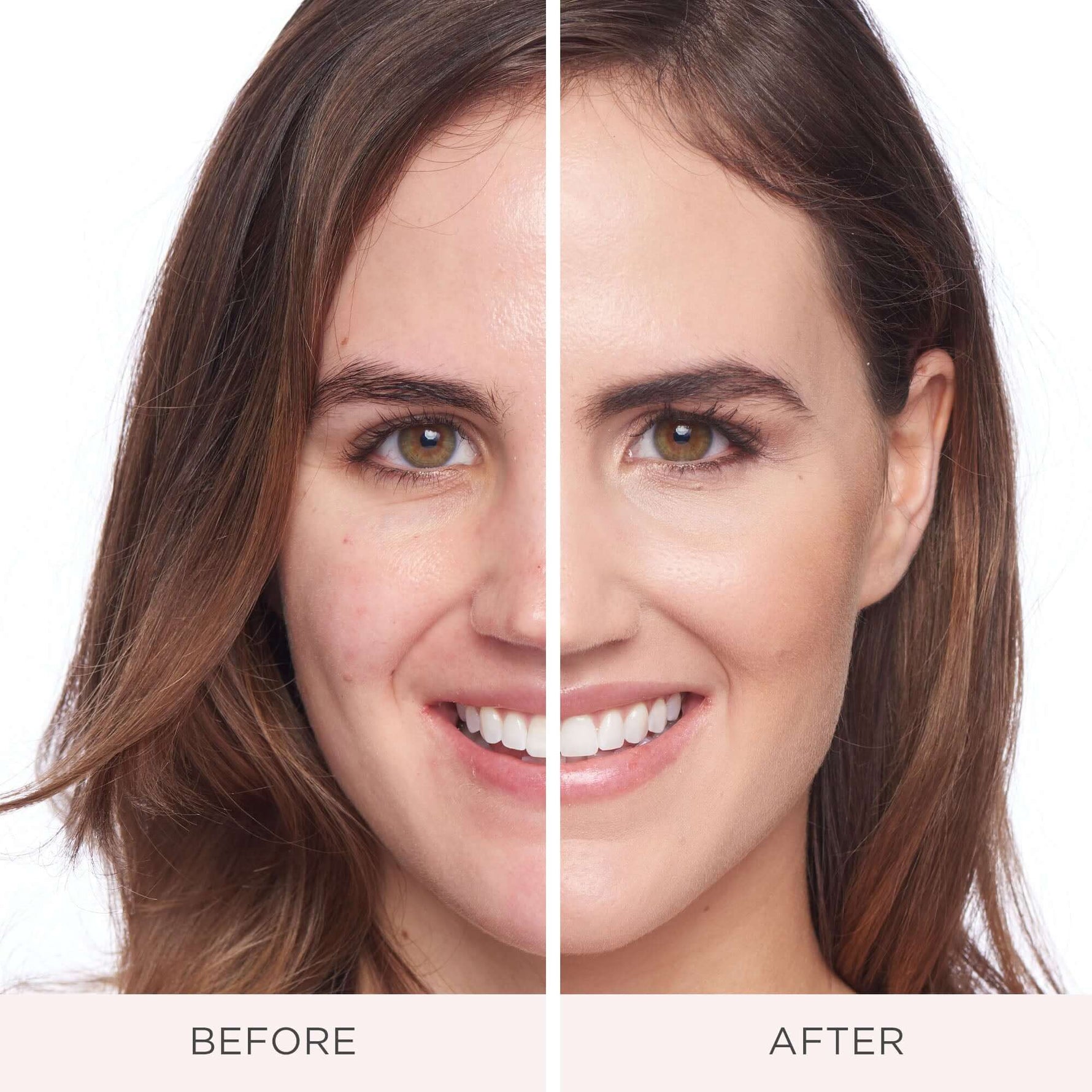 Before and After Model