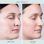 Rescue C Brightening Vitamin C & Peptide Eye Cream - PÜR Beauty