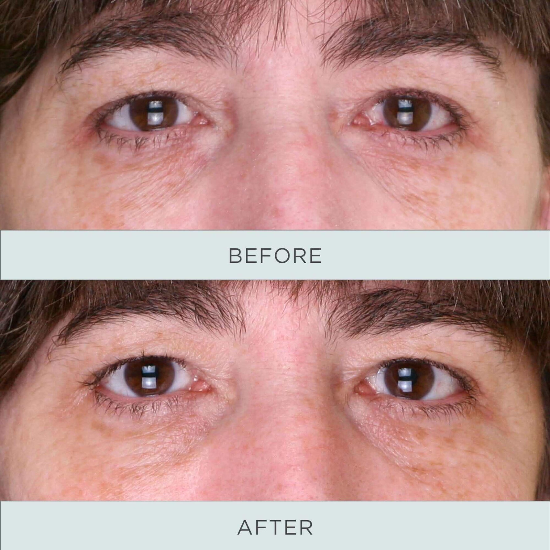 Tone Up Niacinamide Firming Eye Serum - PÜR Beauty